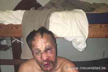 Gevangenisdirectie kreeg op maandag schriftelijk rapport over bebloede persoon, maar schoot niet in actie