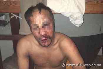 Gevangenisdirectie kreeg maandag al schriftelijk rapport over bebloede persoon, maar schoot niet in actie