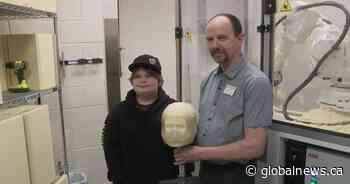 New machine at Glenrose hospital helps patients with artificial limbs, orthotic devices