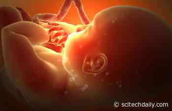 Metformin Danger During Pregnancy: Impact on Offspring Brain Development