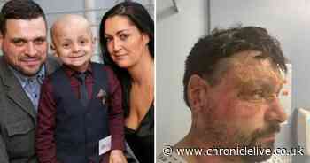 Firm fined £60,000 after Bradley Lowery's dad Carl suffered serious burns in building site incident
