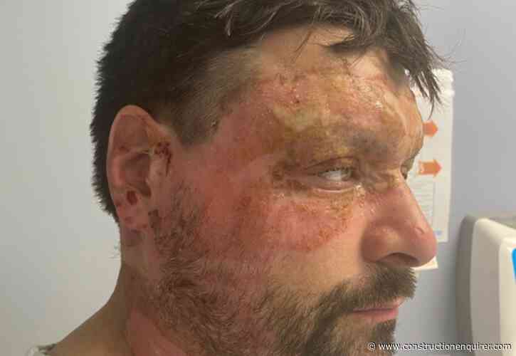 Cable installer suffers horror burns in site electrical flash