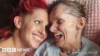 New hope for sisters trapped in their bodies