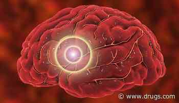 CARv3-TEAM-E T-Cell Treatment Beneficial for Recurrent Glioblastoma