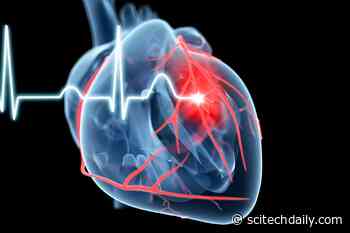 Intermittent Fasting Linked to a 91% Higher Risk of Cardiovascular Death