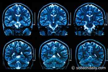 Unlocking the Secrets Behind Age-Related Memory Loss