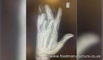 Finger amputations costs pork pie maker £800k fine