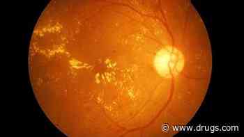Minocycline Does Not Decrease Geographic Atrophy Enlargement in AMD