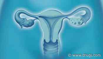 Uterine Artery Embolization Successfully Controls Postpartum Hemorrhage