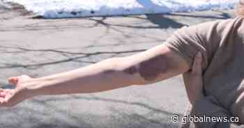 Toronto woman speaks out after being carjacked: ‘We are getting victimized here’