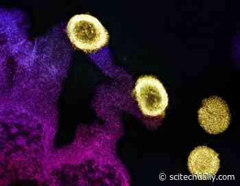 Vanishing Fat: Semaglutide’s Triumph Over HIV Liver Disease