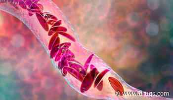 Crude Sickle Cell Birth Prevalence 28.54 per 10,000 in Non-Hispanic Blacks