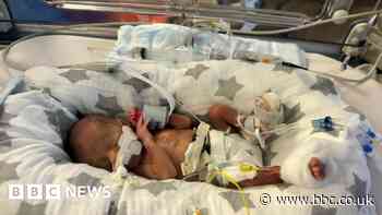 Boxer's premature baby inherits fighting spirit