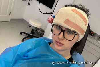 Women branded 'fivehead' by bullies forks out £9,000 for forehead reduction surgery