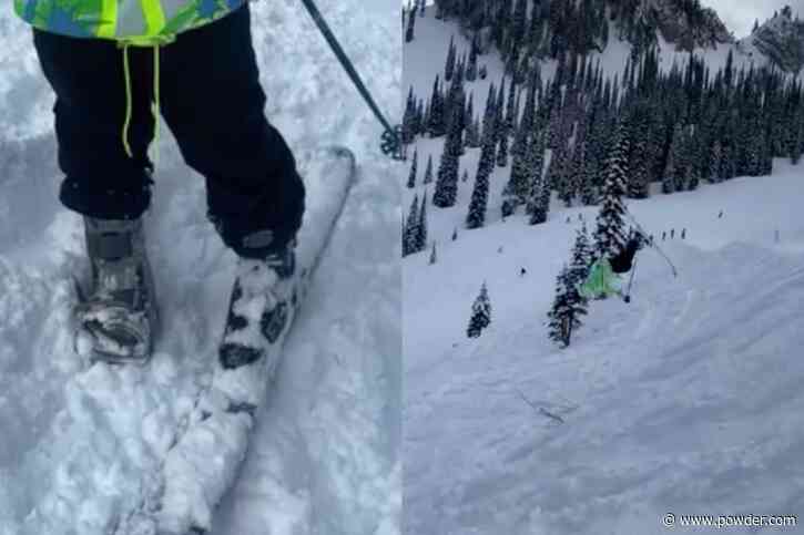 Skier Lands Backflip With One Foot In A Cast