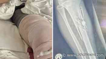 ‘Pay for what he did': Mother speaks out after 14-year-old son gets shot on Miami Beach Boardwalk