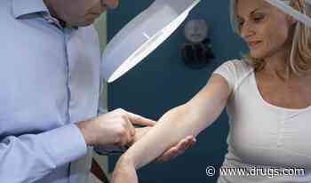 Second Primary Malignancy Risk Increased After Cutaneous B-Cell Lymphoma