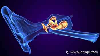 Summating Potential/Action Potential Area Ratio Best for ID'ing Meniere Disease