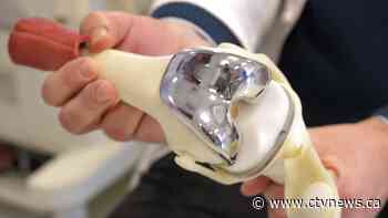 Canadians waiting longer for surgeries and other procedures compared to 2019: report