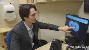 Severe COVID leads to higher risk of pulmonary fibrosis: research