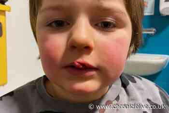 Gateshead boy, 6, needed facial surgery after go-kart crash at County Durham's Holmside Park attraction