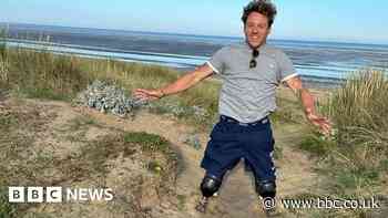 'Losing my legs changed my life for the better'