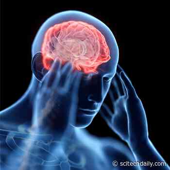 Teenage E-Cigarette Use Linked to Frequent Headaches