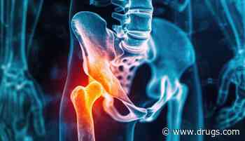 Progressive Resistance Training Not Superior for Hip Osteoarthritis