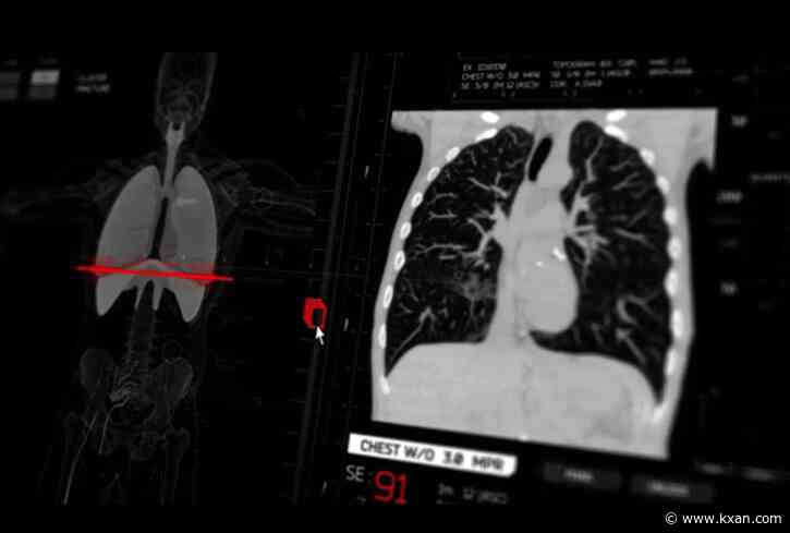 Survey finds 7 in 10 adults skip cancer screenings