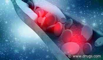Etidronate Beneficial for Arterial Calcification Due to CD73 Deficiency