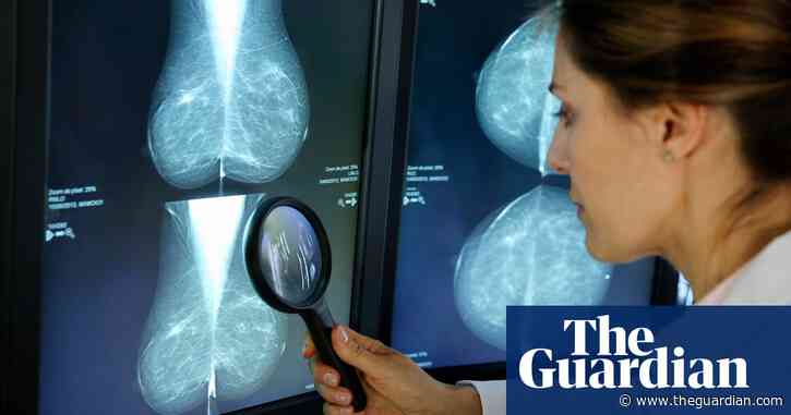 Lower-income US women more likely to miss key breast cancer test, study finds