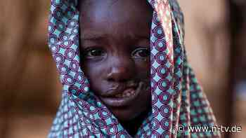 Noma zerfrisst das Gesicht: Diese Infektion tötet jährlich Zehntausende Kinder