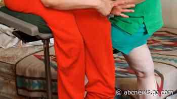 Oldest living conjoined twins, Lori and George Schappell, die at 62