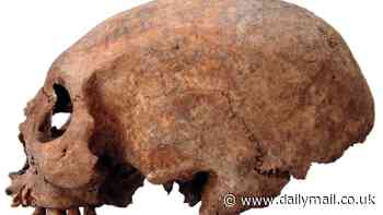 Vikings may have practiced ancient form of plastic surgery 1,000 years ago, study suggests