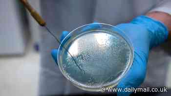 Scientists find 'vampire' bacteria that has a thirst for HUMAN blood