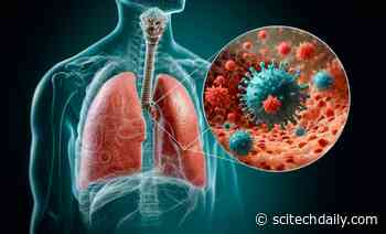 Stanford Medicine Unmasks the Surprising Instigators of Severe COVID in the Lungs