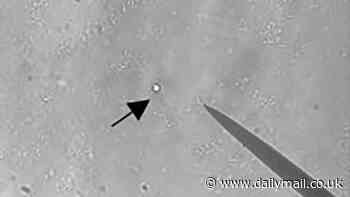 Microplastics are now found in BRAINS and gallstones