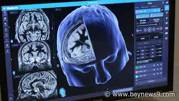 Experts say more diversity is needed in Alzheimer's disease clinical trials