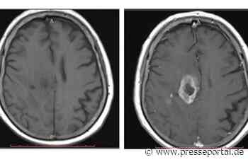 Meilenstein für die radiologische Diagnostik