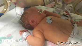 'My son had a stroke when he was 12 minutes old'