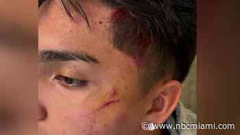 Father demands more after-school security after son beaten unconscious in Coconut Creek fight