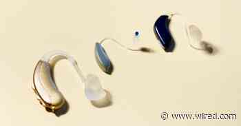 How to Buy a Hearing Aid: Top Questions and Answers