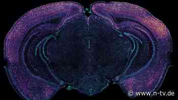 Gamma-Wellen gegen Demenz: Knatterton und Flackerlicht sollen Alzheimer aufhalten