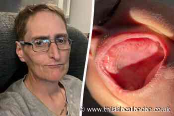 Epping nurse 'has malnutrition' after nearly all her teeth removed