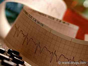 A-Fib More Common in Middle-Aged Folk Than Thought