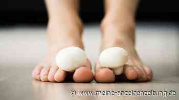 Nagelpilz-Mittel bei Stiftung Warentest: 15 Arzneien sind besonders geeignet