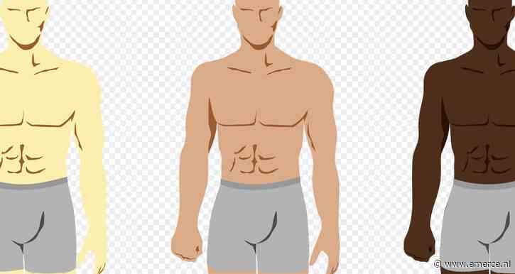 ACM: webwinkel boxershorts On that ass moet duidelijker zijn over abonnement