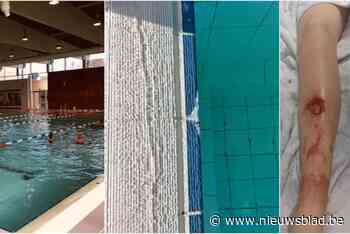 Annabelle (9) raakt gewond in zwembad, mama misnoegd: “Had ze daar haar hand gezet, dan was  een slagader geraakt”