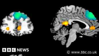 AI study gives 'hope' to childhood trauma survivors