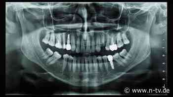 Schock für Patient in Türkei: Zahnarzt bohrt Schraube bis ins Gehirn